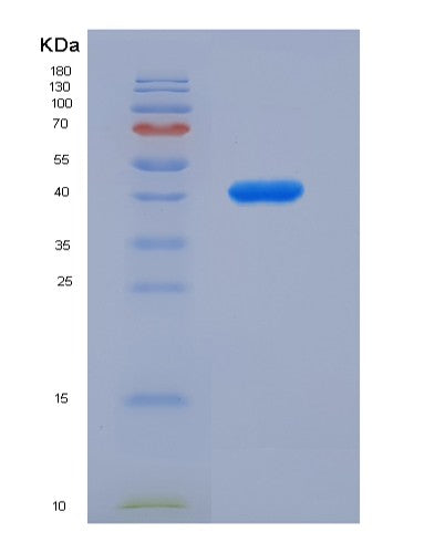 Human GOT1 (Aspartate Aminotransferase, Cytoplasmic) - Recombinant Protein