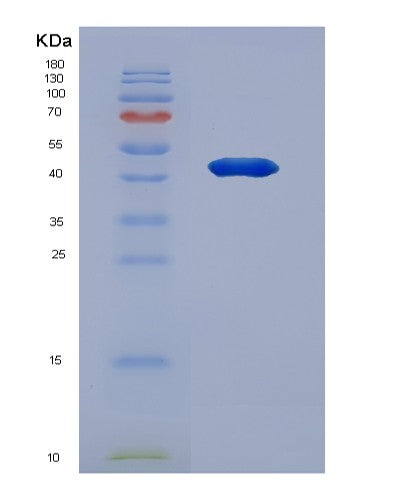 Human GAP43 (Neuromodulin) - Recombinant Protein