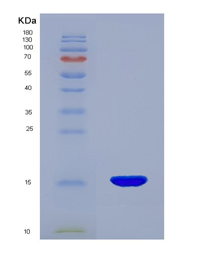 Human ENG (Endoglin) - Recombinant Protein