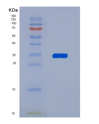 Human NAT1 (Arylamine N-Acetyltransferase 1) - Recombinant Protein