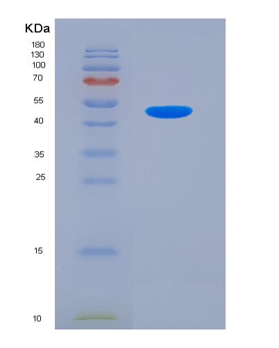 Human VCAM1 (Vascular Cell Adhesion Protein 1) - Recombinant Protein