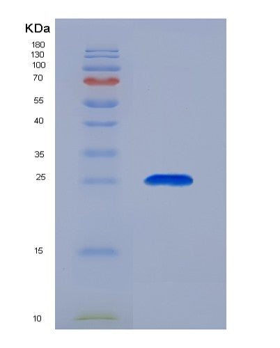 Human ORM2 (Alpha-1-Acid Glycoprotein 2) - Recombinant Protein