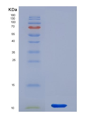 Human CXCL2 (C-X-C Motif Chemokine 2) - Recombinant Protein