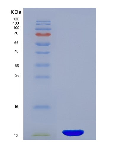 Human PI3 (Elafin) - Recombinant Protein