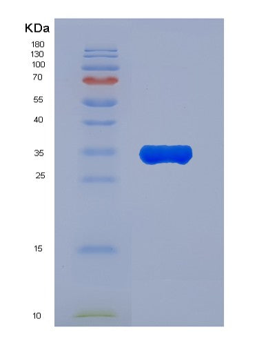 Human ANXA7 (Annexin A7) - Recombinant Protein