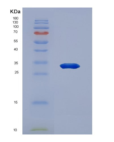 Human MX1 (Interferon-Induced Gtp-Binding Protein Mx1) - Recombinant Protein