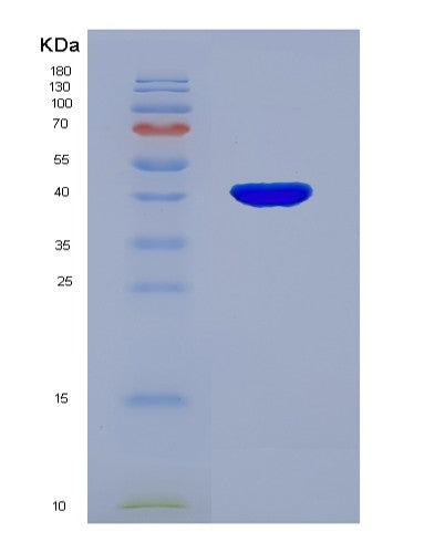 Human NPR2 (Atrial Natriuretic Peptide Receptor 2) - Recombinant Protein