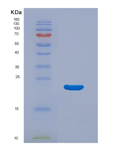 Human M6PR (Cation-Dependent Mannose-6-Phosphate Receptor) - Recombinant Protein
