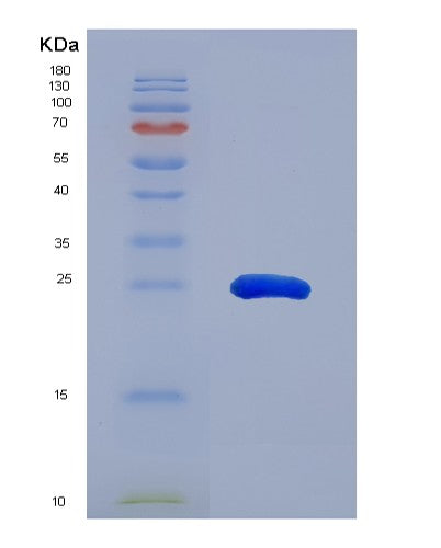 Human DDC (Aromatic-L-Amino-Acid Decarboxylase) - Recombinant Protein