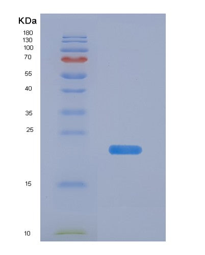 Human EDN2 (Endothelin-2) - Recombinant Protein