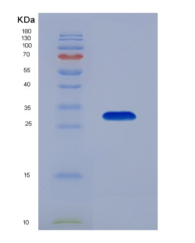 Human AGA (N(4)-(Beta-N-Acetylglucosaminyl)-L-Asparaginase) - Recombinant Protein