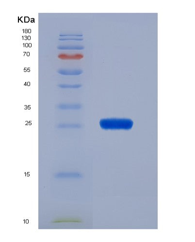 Human GSTM3 (Glutathione S-Transferase Mu 3) - Recombinant Protein