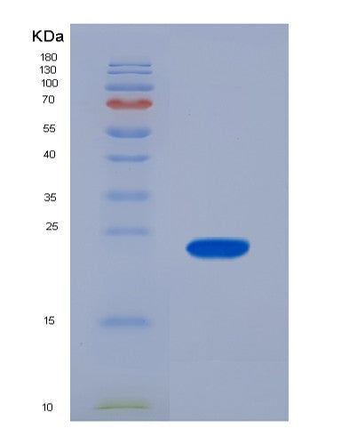Human CSRP1 (Cysteine And Glycine-Rich Protein 1) - Recombinant Protein