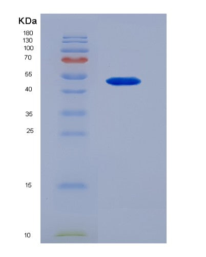 Human NT5E (5'-Nucleotidase) - Recombinant Protein
