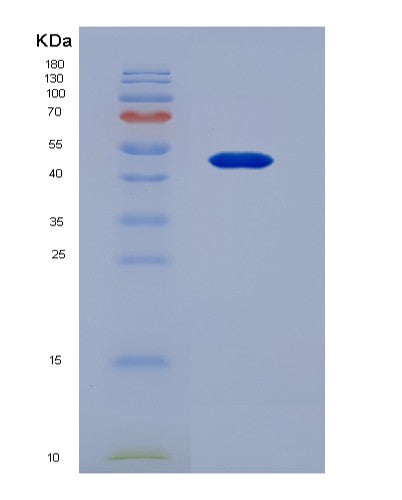 Human MSR1 (Macrophage Scavenger Receptor Types I And Ii) - Recombinant Protein