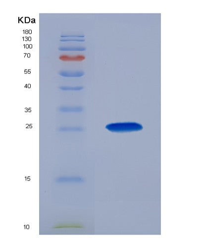 Human COMT (Catechol O-Methyltransferase) - Recombinant Protein