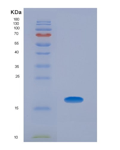 Human BMP5 (Bone Morphogenetic Protein 5) - Recombinant Protein