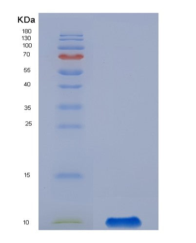 Human GPX3 (Glutathione Peroxidase 3) - Recombinant Protein