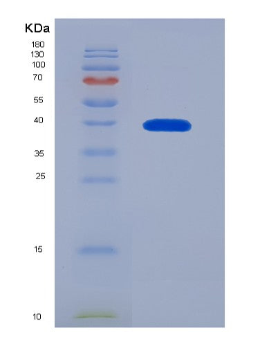 Human CCL1 (C-C Motif Chemokine 1) - Recombinant Protein