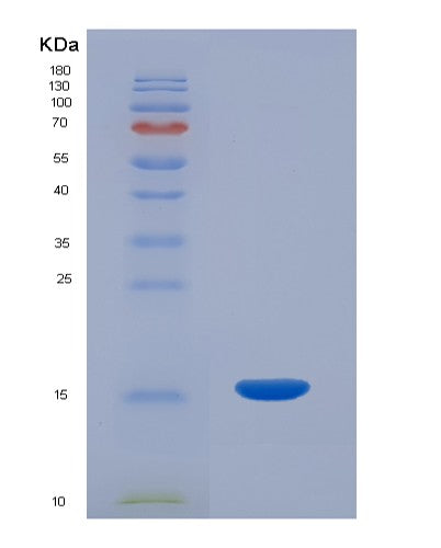 Human GAL (Galanin Peptides) - Recombinant Protein