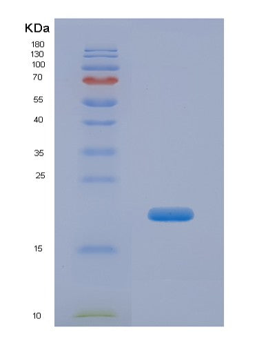 Human CPN2 (Carboxypeptidase N Subunit 2) - Recombinant Protein