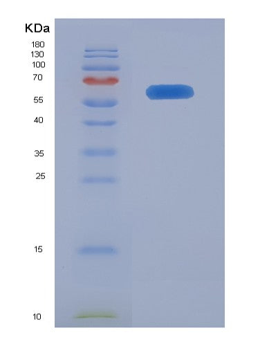 Human XPA (Dna Repair Protein Complementing Xp-A Cells) - Recombinant Protein