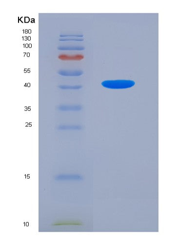 Human VAMP1 (Vesicle-Associated Membrane Protein 1) - Recombinant Protein