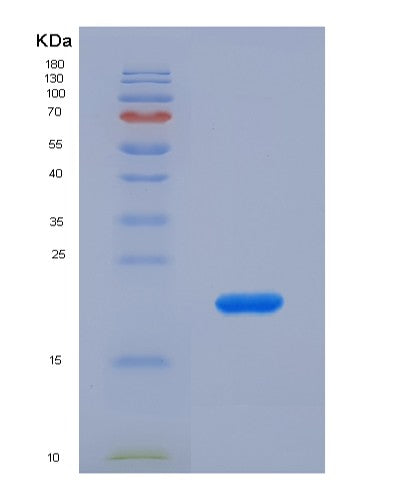 Human DTYMK (Thymidylate Kinase) - Recombinant Protein