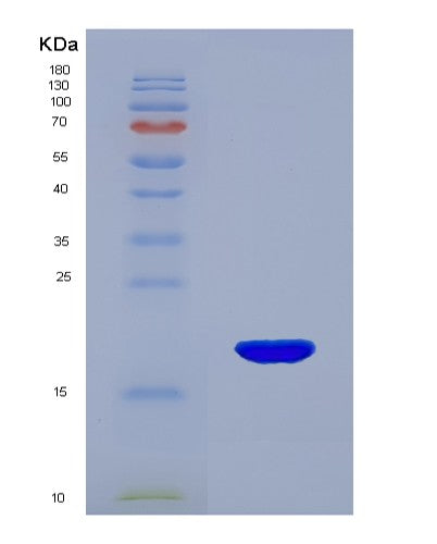 Human MYL9 (Myosin Regulatory Light Polypeptide 9) - Recombinant Protein