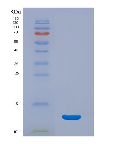 Human CDK2 (Cyclin-Dependent Kinase 2) - Recombinant Protein