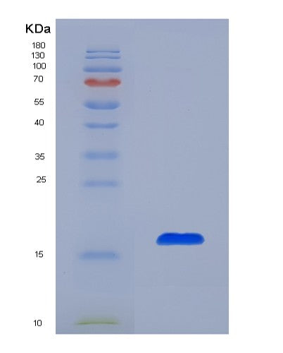Human AZGP1 (Zinc-Alpha-2-Glycoprotein) - Recombinant Protein