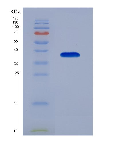 Human DNAJB1 (Dnaj Homolog Subfamily B Member 1) - Recombinant Protein