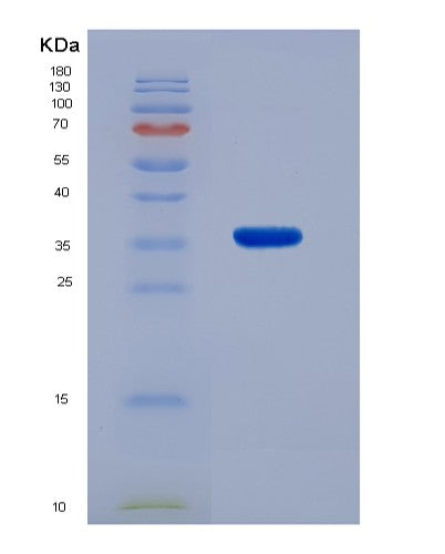 Human DNAJB2 (Dnaj Homolog Subfamily B Member 2) - Recombinant Protein