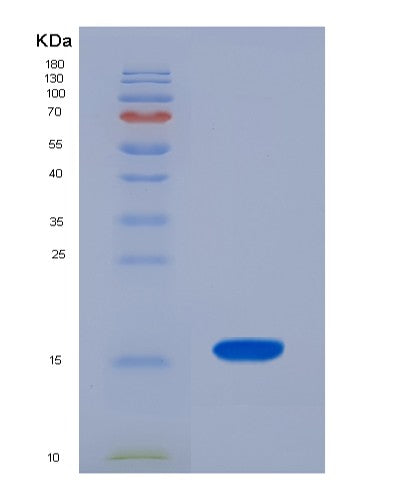 Human MT3 (Metallothionein-3) - Recombinant Protein