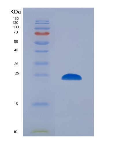 Human CTSS (Cathepsin S) - Recombinant Protein