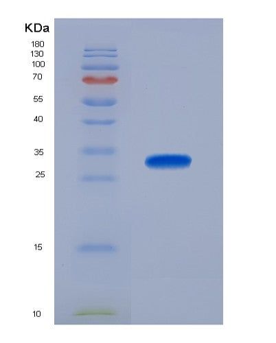 Human PSMA1 (Proteasome Subunit Alpha Type-1) - Recombinant Protein