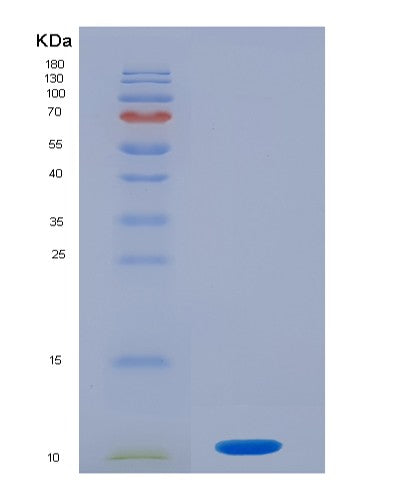 Human S100P (Protein S100-P) - Recombinant Protein