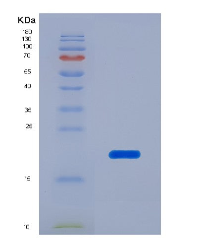 Human NFKBIA (Nf-Kappa-B Inhibitor Alpha) - Recombinant Protein