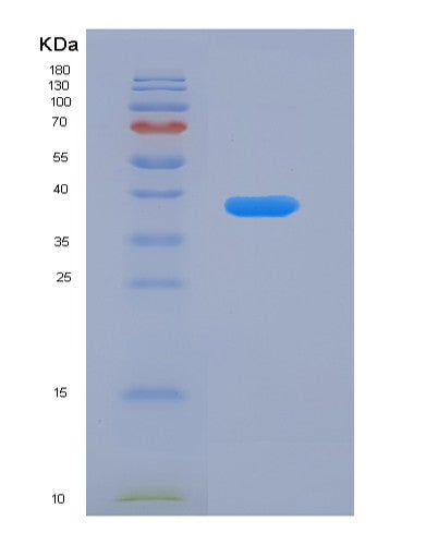 Human MSN (Moesin) - Recombinant Protein