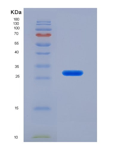 Human IVD (Isovaleryl-Coa Dehydrogenase, Mitochondrial) - Recombinant Protein