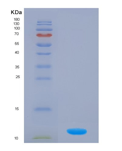 Human S100A4 (Protein S100-A4) - Recombinant Protein