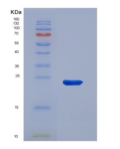 Human POLE3 (Dna Polymerase Epsilon Subunit 3) - Recombinant Protein