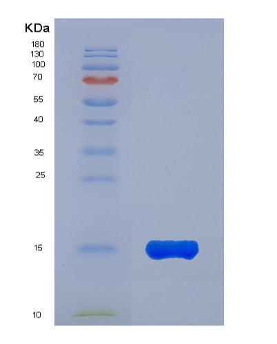 Human KLRK1 (Nkg2-D Type Ii Integral Membrane Protein) - Recombinant Protein