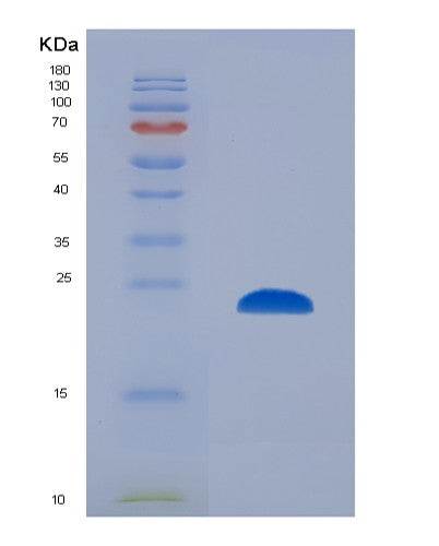 Human PSMB8 (Proteasome Subunit Beta Type-8) - Recombinant Protein