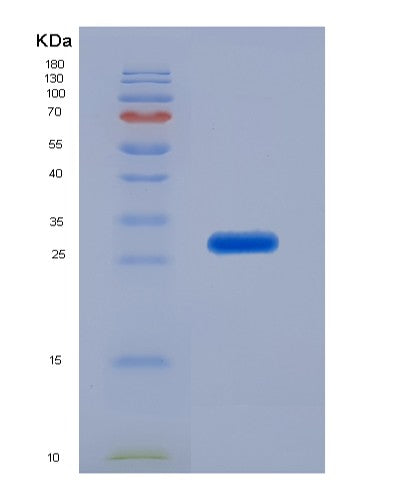 Human PSMA5 (Proteasome Subunit Alpha Type-5) - Recombinant Protein