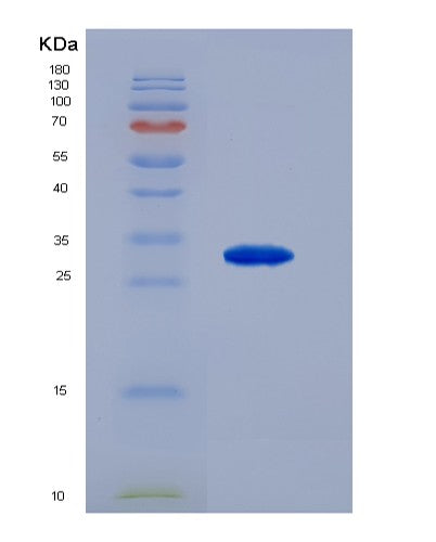 Human PSMB4 (Proteasome Subunit Beta Type-4) - Recombinant Protein