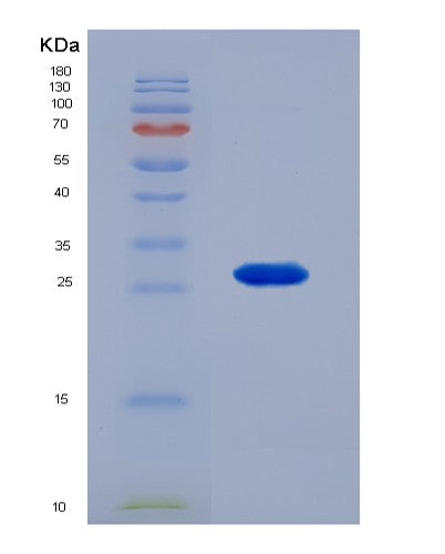 Human PSMB6 (Proteasome Subunit Beta Type-6) - Recombinant Protein