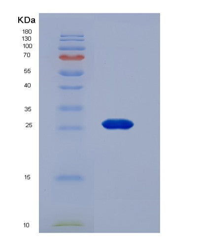 Human GSTM2 (Glutathione S-Transferase Mu 2) - Recombinant Protein