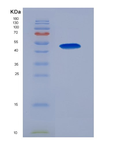 Human LOX (Protein-Lysine 6-Oxidase) - Recombinant Protein