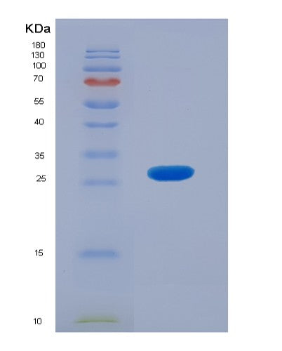 Human ACADL (Long-Chain Specific Acyl-Coa Dehydrogenase, Mitochondrial) - Recombinant Protein